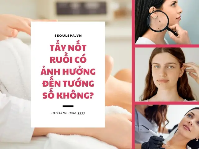 Tẩy Nốt Ruồi Có Ảnh Hưởng Đến Tướng Số Không