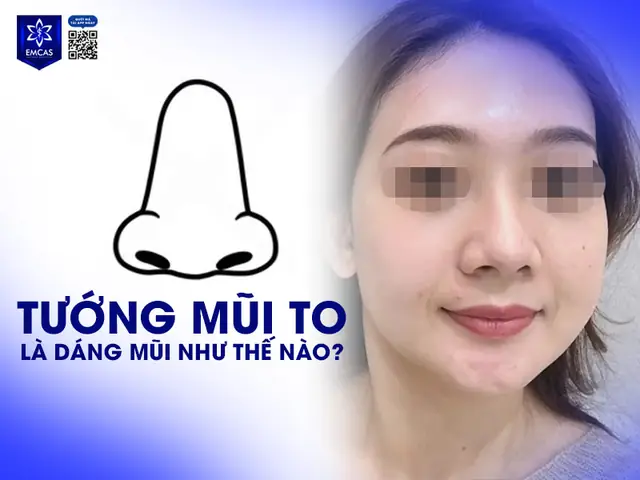 Thế Nào Là Tướng Mũi Xấu Thế Nào Là Tướng Mũi Xấu