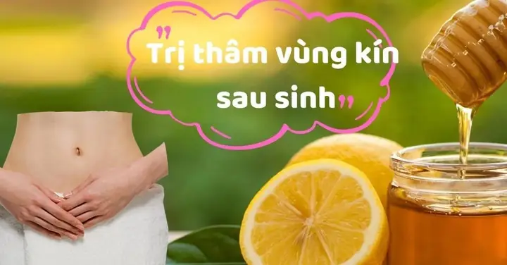 Trị Thâm Vùng Kín Sau Sinh Trị Thâm Vùng Kín Sau Sinh