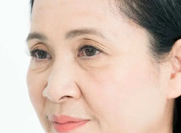 Tướng Mắt Ba Mí Tướng Mắt Ba Mí