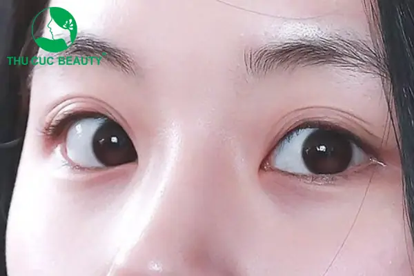 Tướng Mắt Ba Mí Tướng Mắt Ba Mí
