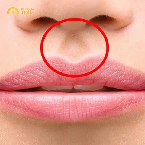 Tướng Mặt Đường Nhân Trung