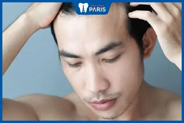 Tướng Mặt Gồ Ghề Tướng Mặt Gồ Ghề