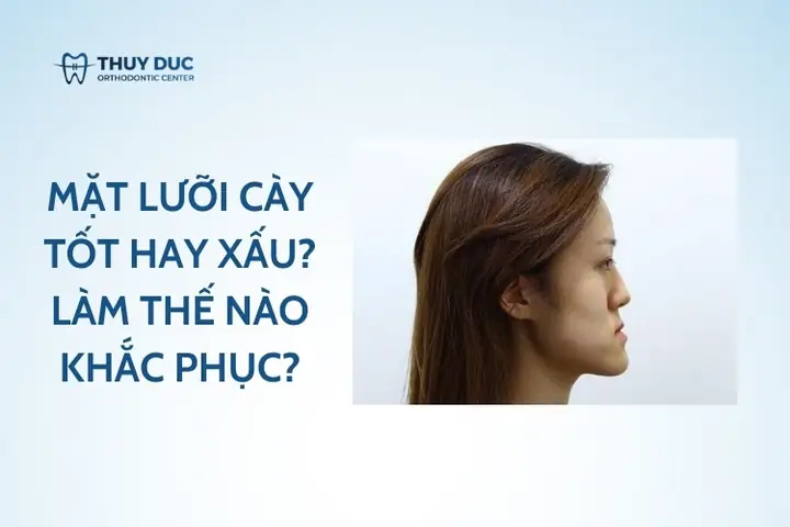 Tướng Mặt Không Tốt Tướng Mặt Không Tốt