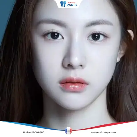 Tướng Mặt Kim Cương Tướng Mặt Kim Cương