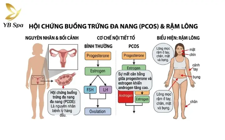 Tướng Mặt Nhiều Lông Tướng Mặt Nhiều Lông