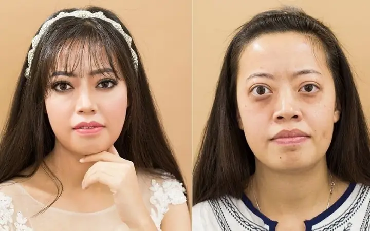 Tướng Mắt Ốc Nhồi Tướng Mắt Ốc Nhồi