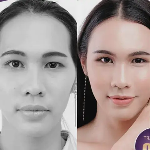 Tướng Mặt Thái Dương Hopa Tướng Mặt Thái Dương Hopa