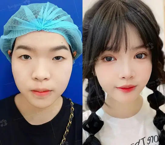 Tướng Mặt Thay Đổi Tướng Mặt Thay Đổi