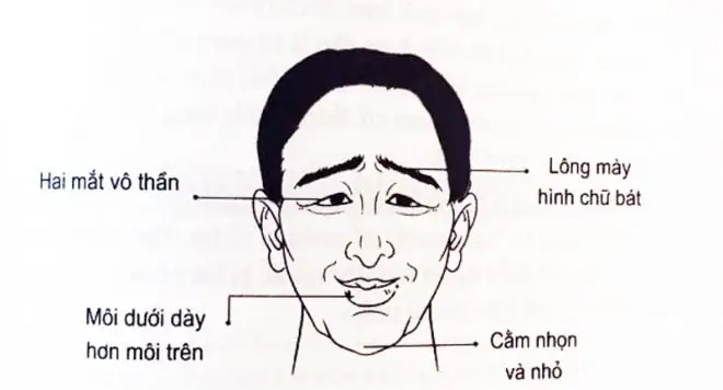 Tướng Mặt Tiểu Nhân Tướng Mặt Tiểu Nhân