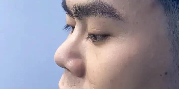 Tướng Mũi Đàn Ông Tốt