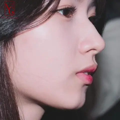Tướng Mũi Gồ Lên Tướng Mũi Gồ Lên