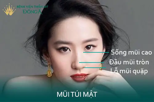 Tướng Mũi Mật Treo Tướng Mũi Mật Treo