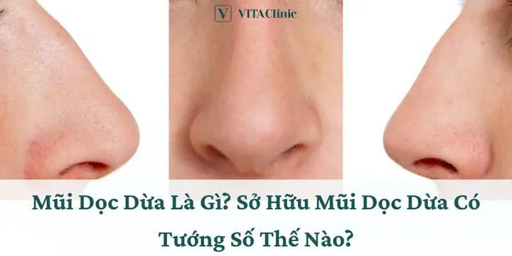 Tướng Mũi Như Thế Nào Là Đẹp Tướng Mũi Như Thế Nào Là Đẹp
