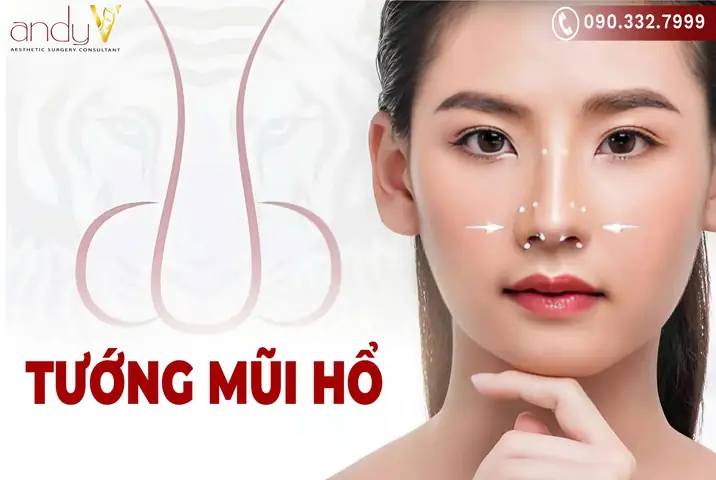 Tướng Mũi Tê Giác