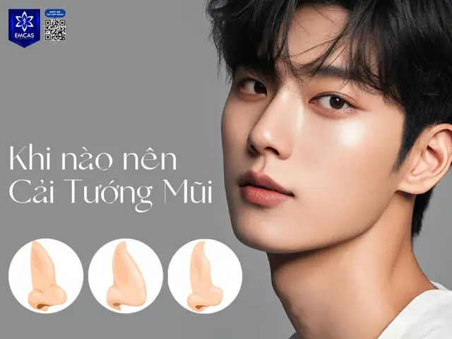 Tướng Mũi To Nam Tướng Mũi To Nam