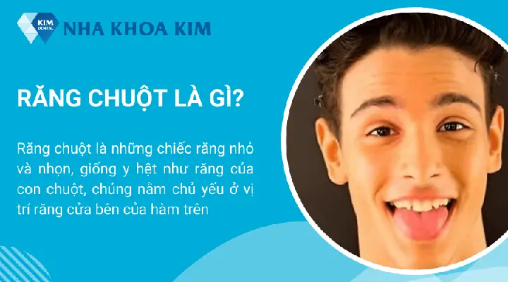 Tướng Răng Cửa Răng Chuột Tướng Răng Cửa Răng Chuột