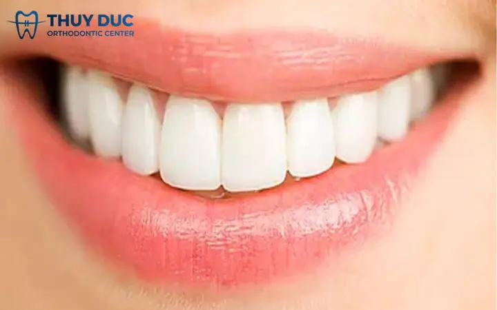 Tướng Răng Cửa To Tướng Răng Cửa To