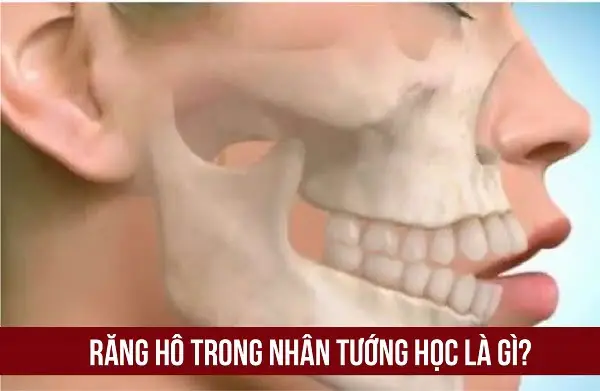 Tướng Răng Hổ Là Như Thế Nào Tướng Răng Hổ Là Như Thế Nào