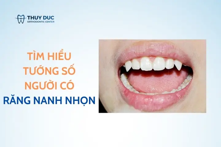 Tướng Răng Hổ Là Như Thế Nào Tướng Răng Hổ Là Như Thế Nào