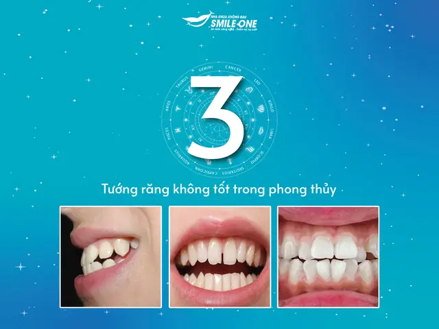 Tướng Răng Khấp Khểnh Tướng Răng Khấp Khểnh