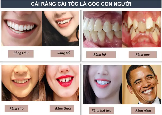 Tướng Răng Tính Cách Tướng Răng Tính Cách