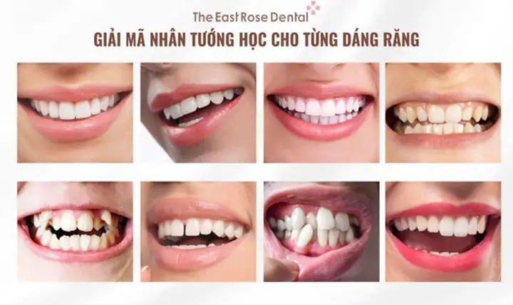 Tướng Răng Tính Cách Tướng Răng Tính Cách