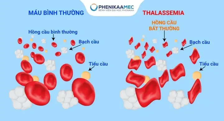 Tướng Số Của Người Có Quai Hàm Bạnh