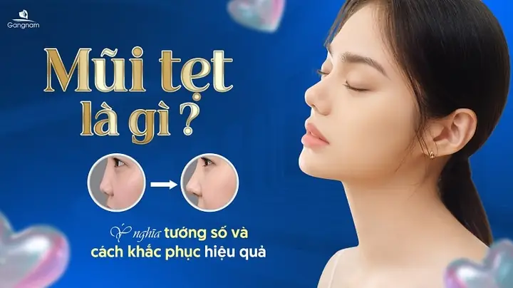Tướng Số Qua Mũi Tướng Số Qua Mũi