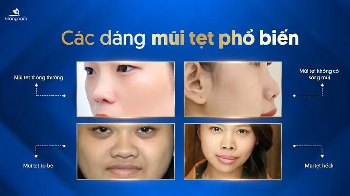 Tướng Số Qua Mũi Tướng Số Qua Mũi