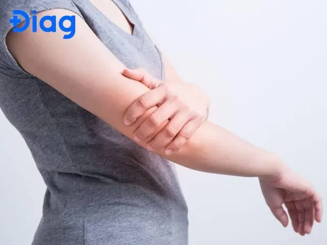 Tướng Tay Cán Vá Tướng Tay Cán Vá