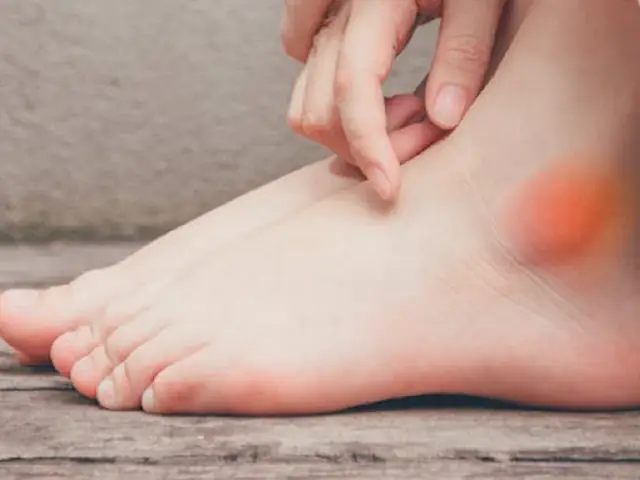 Xem Tướng Mắt Cá Chân Xem Tướng Mắt Cá Chân