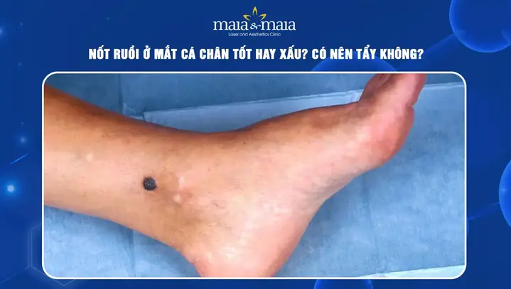 Xem Tướng Mắt Cá Chân Xem Tướng Mắt Cá Chân