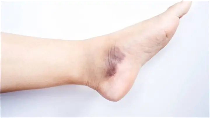 Xem Tướng Mắt Cá Chân Xem Tướng Mắt Cá Chân