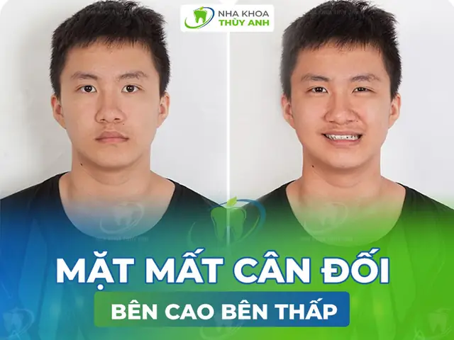 Xem Tướng Mặt Lệch Xem Tướng Mặt Lệch