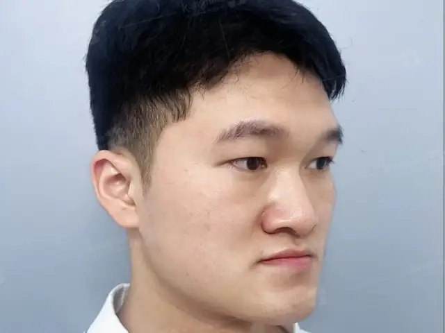Xem Tướng Mặt Lưỡi Cày Xem Tướng Mặt Lưỡi Cày
