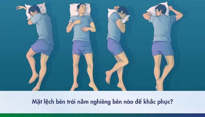 Xem Tướng Mặt Nghiêng