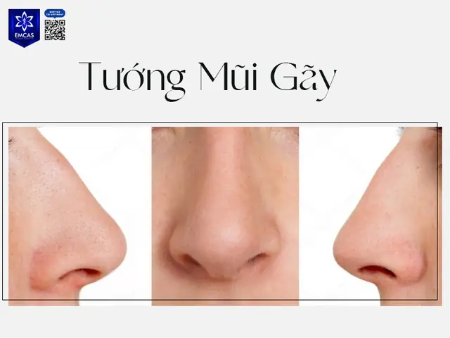 Xem Tướng Mũi Người Xấu Xem Tướng Mũi Người Xấu