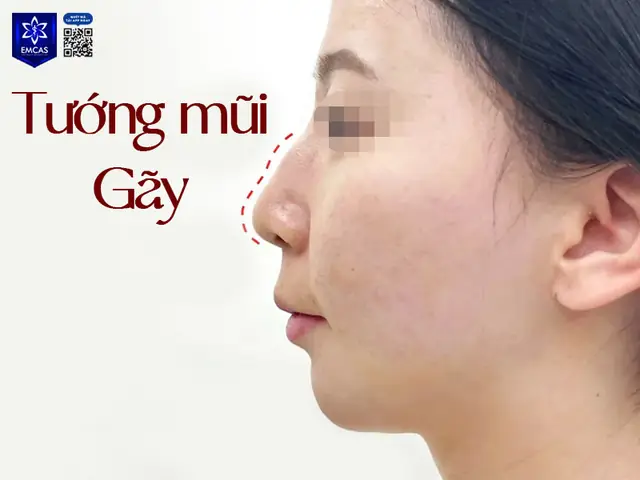 Xem Tướng Mũi Ở Nữ Xem Tướng Mũi Ở Nữ