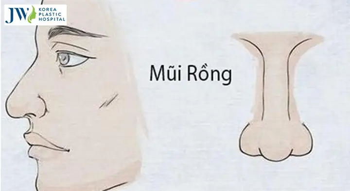Xem Tướng Mũi Rồng Xem Tướng Mũi Rồng