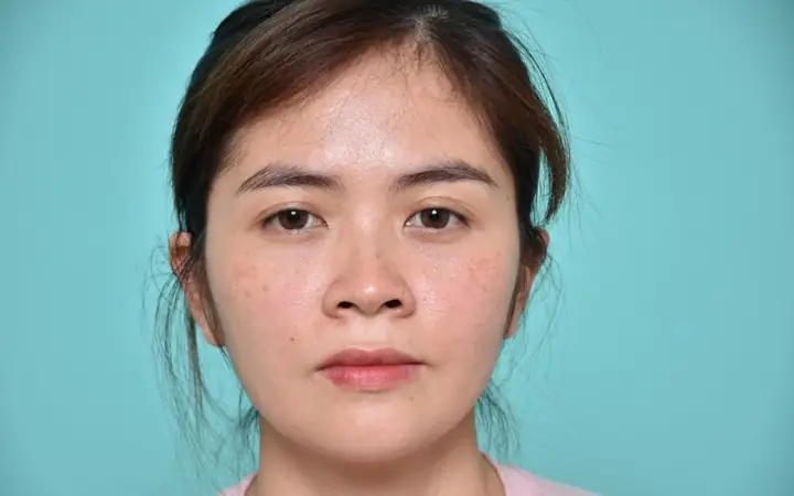 Xem Tướng Mũi To Lộ Lỗ Mũi Xem Tướng Mũi To Lộ Lỗ Mũi