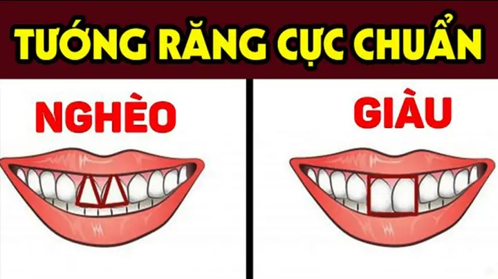 Xem Tướng Răng Cửa Hở