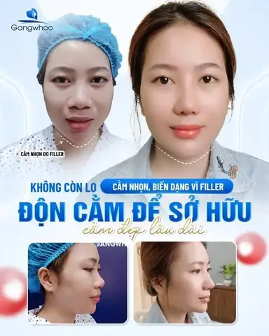 Cằm Giật La Điềm Gì Cằm Giật La Điềm Gì