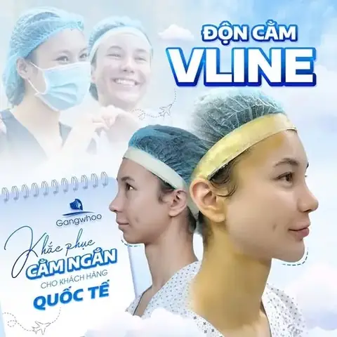 Cằm Giật La Điềm Gì Cằm Giật La Điềm Gì