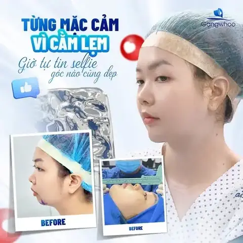 Cằm Giật La Điềm Gì Cằm Giật La Điềm Gì