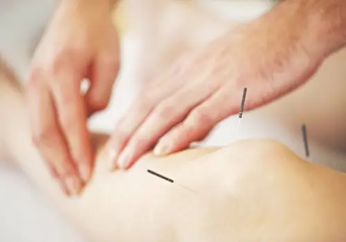 Top 10+ Địa Chỉ Châm Cứu, Bấm Huyệt Quận 7 Uy Tín Và Hiệu Quả Nhất