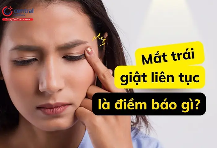 Có Điềm Là Gì Có Điềm Là Gì