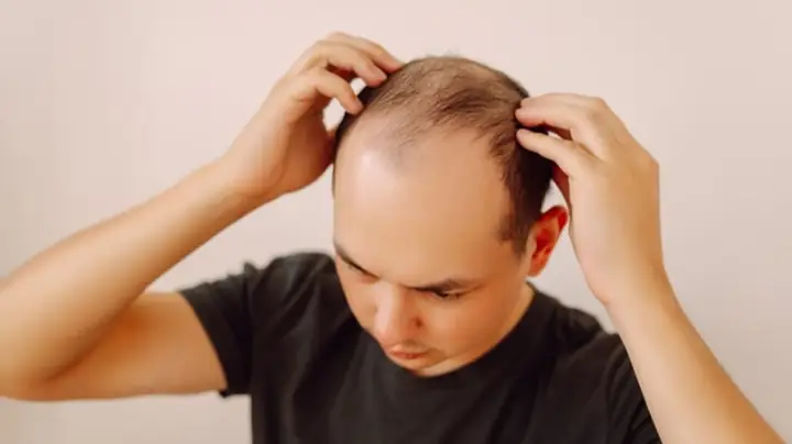 Điềm Báo Giấc Mơ Thấy Tóc Rụng Điềm Báo Giấc Mơ Thấy Tóc Rụng