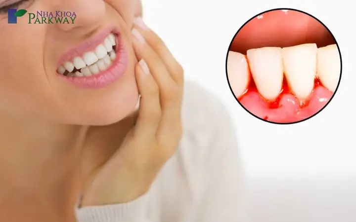 Giải Mã Giấc Mơ Bị Sâu Răng: Ý Nghĩa, Dấu Hiệu Và Cách Đối Phó