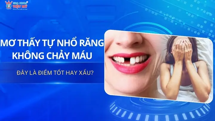 Giải Mã Giấc Mơ Đi Nhổ 2 Cái Răng Giải Mã Giấc Mơ Đi Nhổ 2 Cái Răng